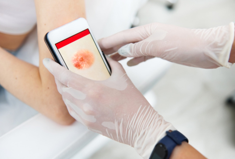 La dermatologie dans l’ère du numérique | Réseau québécois de la télésanté