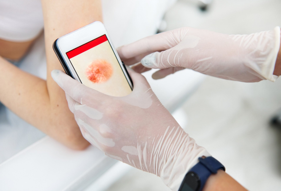 Médecin utilisant un téléphone mobile pour photographier une lésion cutanée